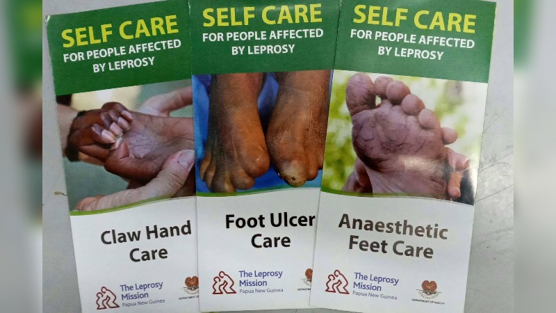“LEPROSY IS CURABLE”