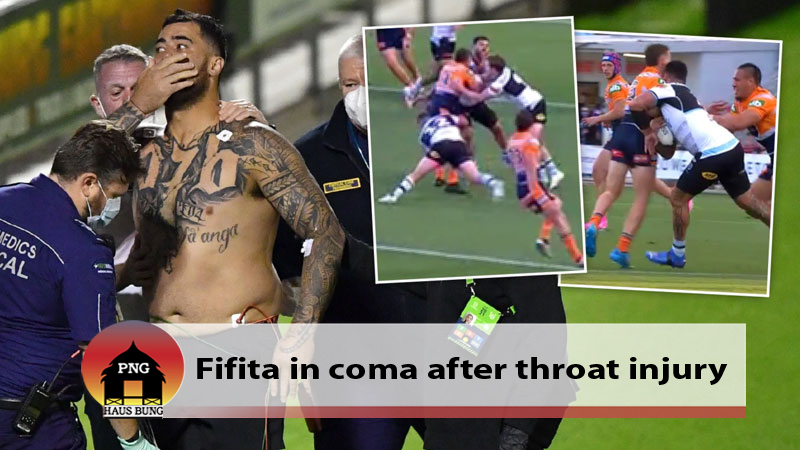 FIFITA IN AN INDUCED COMA