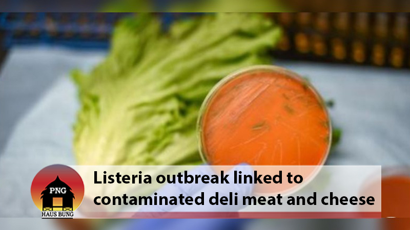 LISTERIA OUTBREAK: HOW TO PROTECT YOURSELF FROM THE DEADLY FOODBORNE BACTERIA