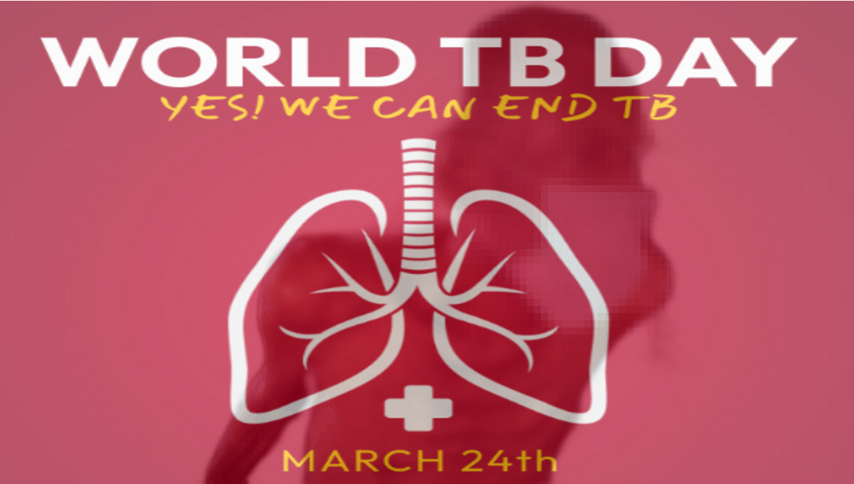 MORE SCREENING NEEDED TO STOP SPREAD OF TB