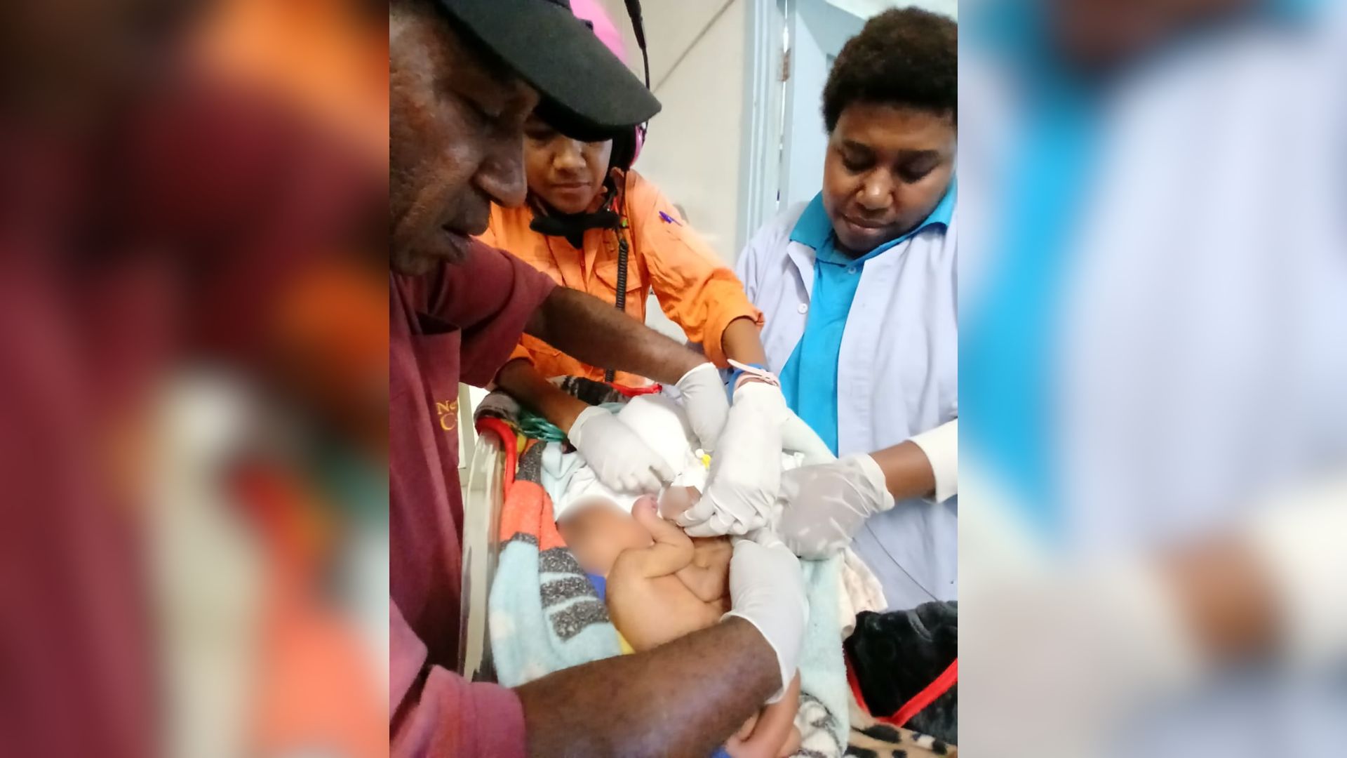 RARE CASE OF CONJOINED TWINS DELIVERED AT BRAUN HOSPITAL