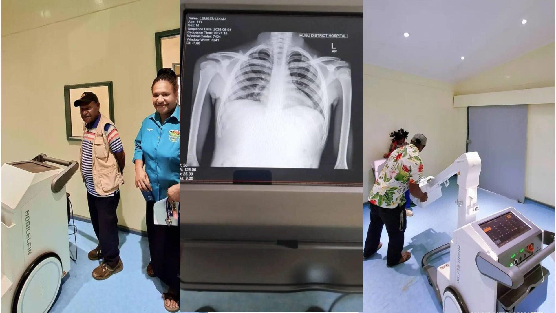 IALIBU DISTRICT HOSPITAL RESTORES X-RAY SERVICES 